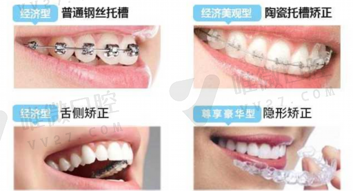 假牙清洁片分类及区别图解,请问假牙清洁片怎么用呢(图1)